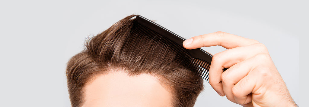 Hair Loss Statistics and 5 Other Important Facts