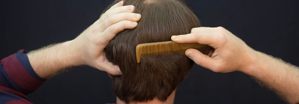 6 Facts About Hair Loss You Never Knew Existed