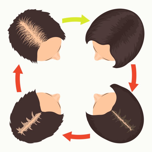 The Definitive Guide to Hair Loss for Women